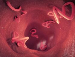 Tubuh Balita Dipenuhi Cacing, Dokter Ingatkan Pentingnya Resep Cacing