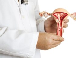 Sakit Kepala Saat Haid Datang, Awas Mungkin Endometriosis di Otak